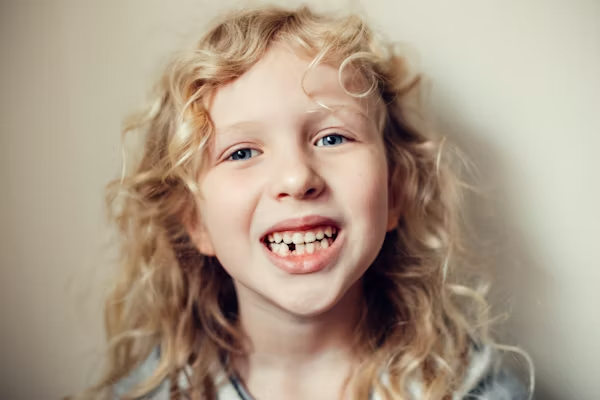 Dent cassée : que faire en attendant le dentiste ?