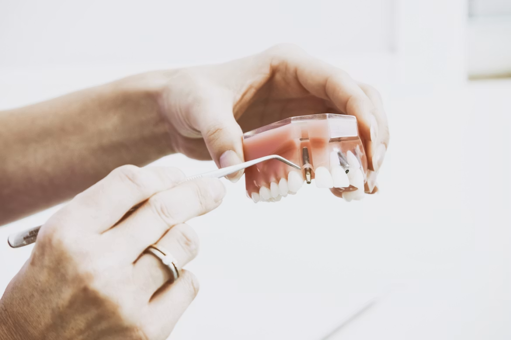 Taches blanches sur les dents : causes et traitements