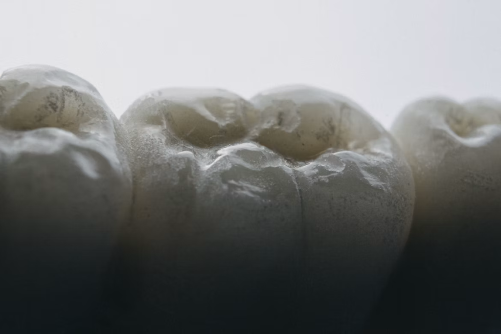 Taches blanches sur les dents : causes et traitements