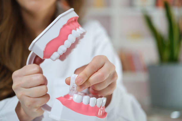 Bleu et gonflement après extraction des dents de sagesse : normal ou pas ?