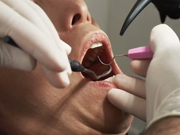 Infection d'une dent dévitalisée : signes, causes et traitement