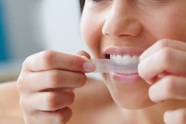 Stylo blanchiment des dents : le comparatif honnête avant d'acheter