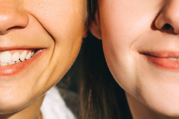 Stylo blanchiment des dents